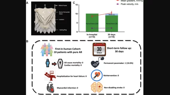 The Pioneer TAVR system from KOKA Lifesciences