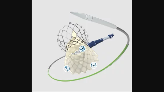 Medtronic's Evolut FX TAVR valve, designed with 3 golden markers that improve alignment.