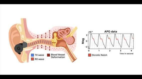 Image and caption courtesy of Google. APG sends a low intensity ultrasound transmitting wave (TX wave) using an ANC headphone's speakers and collects the receiving wave (RX wave) via the on-board feedback microphones. The APG signal is a pulse-like waveform that synchronizes with heartbeat and reveals rich cardiac information. Audioplethysmography Google headphones.