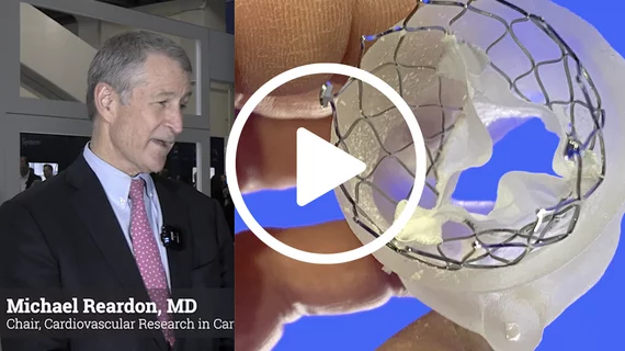Video of Michael Reardon, MD, explaining details from the Evolute Low Risk 4-year results at TCT 2023.