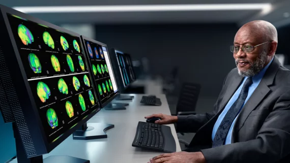 Brain nuclear imaging workstation, GE Healthcare Xeleris 4 DR. GE RSNA PR image