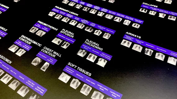 AI applications developed by Annalise.ai and commercialized outside the U.S. The company is working on gaining FDA for these and had several FDA clearances granted this past year. Photo by Dave Fornell. #RSNA #RSNA23 #RSNA2023