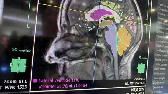 Brain MRI AI assessment and segmentation on Fujifilm's Synapse system at RSNA 2023. Photo by Dave Fornell. #RSNA #RSNA23 #RSNA2023