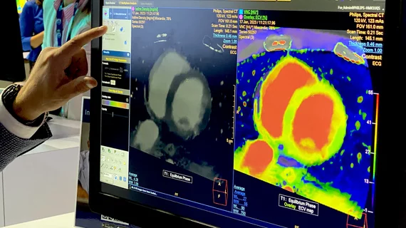 Example of cardiac CT and how spectral imaging assessment of the scan and show areas myocarditis as part of a demo in the Philips booth at RSNA 2023. Cardiac CT took center stage in all of the large CT vendors this year at RSNA and four new CT scanners where introduced, all of which were being promoted for their cardiac imaging capabilities. Photo by Dave Fornell #RSNA #YesCCT #RSNA23 #RSNA2023