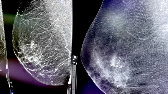 GE HealthCare Breast Cancer AI