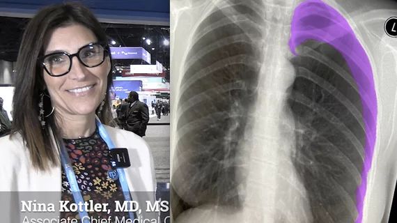 Video interview with Nina Kottler, MD, MS, associate chief medical officer for clinical AI, Radiology Partners, explains what radiology practices should consider when assessing artificial intelligence (AI) return on investment in an era where there is little reimbursement. #RSNA #RSNA23 #RSNA2023 #HealthAI #AIhealthcare