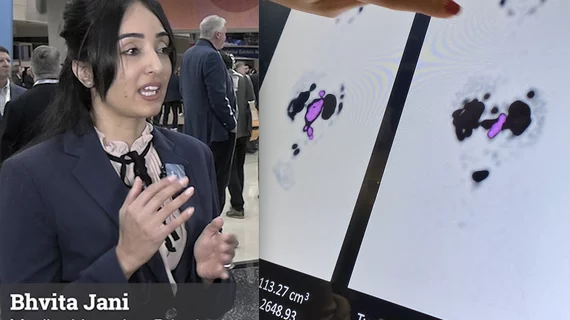 Bhvita Jani, medical imaging principal analyst, Signify Research, discusses growing trend of theragnostics in nuclear imaging and oncology at RSNA2023. #theragnostics #RSNA #RSNA23 #RSNA2023 #radiology #NucMed #Oncology