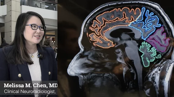 Melissa Chen, MD, Clinical Neuroradiologist, Associate Professor, University of Texas MD Anderson Cancer Center, said challenges ton radiology include the limitations of the relative value units (RVUs) used to pay radiologists, the need for balancing workloads despite disincentives to reading some studies, and the need to find new workflow efficiencies with AI to offset the radiologist shortage. #RSNA
