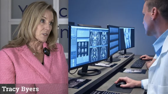 Video of Tracy Byers, CEO, Change Healthcare, explaining trends in the PACS market at RSNA 2023. #RSNA #enterpriseimaging #PACS #HealthIT