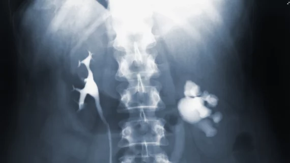radiograph x-ray