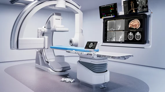 azurion_neuro_biplane_system_Philips
