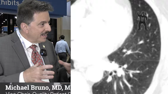 The rate of radiology reading errors has not changed in 75 years, despite technology advances, explains Michael Bruno, MD, Penn State Hershey Medical Center, who outlines the reasons why.
