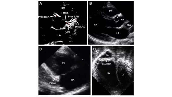 transthoracic echocardiogram images from 2024 ASE guidelines