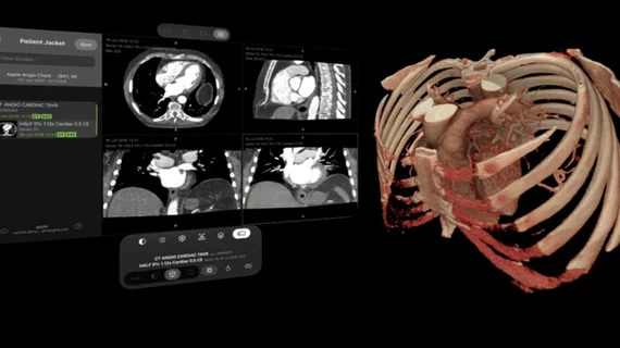 Visage Ease VP Apple Vision application