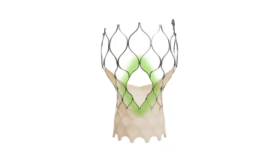 Medtronic has received U.S. Food and Drug Administration (FDA) approval for its Evolut FX+ transcatheter aortic valve replacement (TAVR) system for the treatment of symptomatic severe aortic stenosis. 