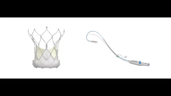 Abbott's Navitor TAVR valve