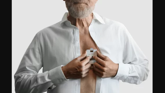 The HeartBeam AIMIGo device is approximately the size of a credit card and uses the company’s patented 3D vectorelectrocardiography (3D VECG) technology to capture signals from three different projections and deliver a synthesized 12-lead ECG. 