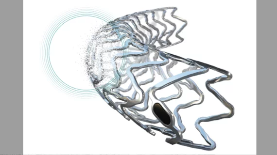 Biotronik has received the FDA’s breakthrough device designation for its Freesolve below-the-knee resorbable magnesium scaffold (BTK RMS) for patients with chronic limb-threatening ischemia (CLTI).