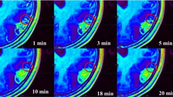 time-delayed MRI phases improve brain tumor visualization