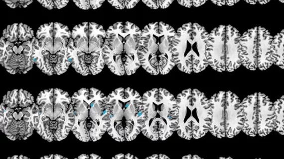 depression and alcohol lead to impairment in functional connectivity of the brain