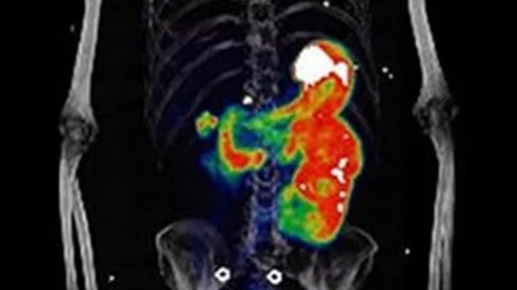 Whole-body maximum-intensity projections over time after [68Ga]Ga-DPI-4452 administration. 