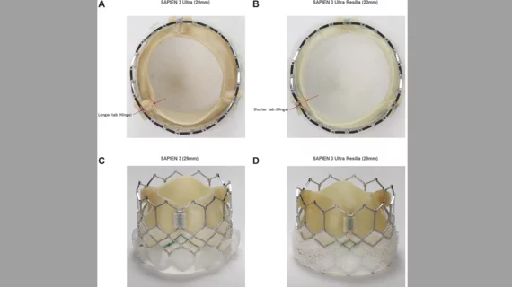 Edwards Lifesciences Sapien 3 Ultra Resilia TAVR