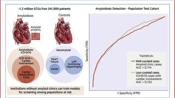 The central illustration from a study that shows the impact of ECG AI algorithm study case and control selection to train artificial intelligence to better screening patients for cardiac amyloidosis. Image courtesy of JACC Advances.