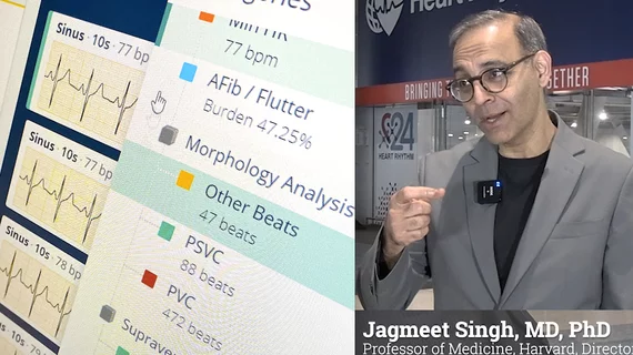 Jagmeet Singh, MD, PhD, Professor of Medicine, Harvard Medical School, and Founding Director of the Resynchronization and Advanced Cardiac Therapeutics Program at Mass General Hospital, delivered a key note address at HRS 2024 on the future of artificial intelligence in EP and AI applications in cardiology. #HRS #EPeeps #HRS2024 #HRS24 #HealthAI