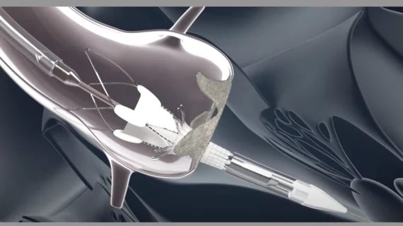 Boston Scientific ACURATE neo2 aortic valve system self-expanding TAVR valve