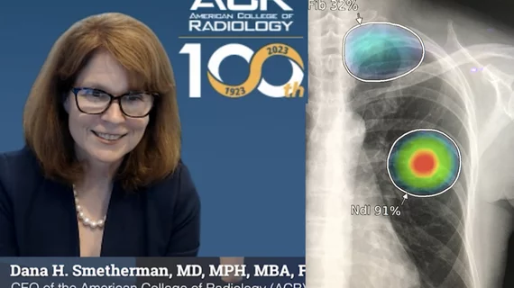 American College of Radiology (ACR) CEO Dana H. Smetherman, MD, MPH, MBA, FACR, explains why opportunistic screening is an important AI imaging technology trend radiology practices should be paying attention. 