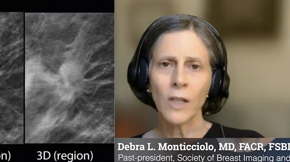Video interview with Debra Monticciolo, MD, on the expansion of DBT and reducing breast imaging recall rates.