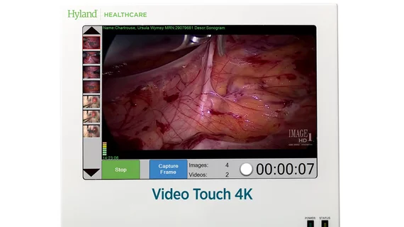 Video Touch 4k