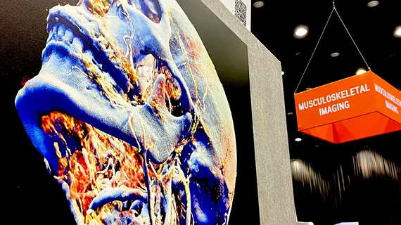 Art by Maki Sugimoto. MSK Musculoskeletal head and neck CT 3D reconstruction art radiology RSNA 2024.