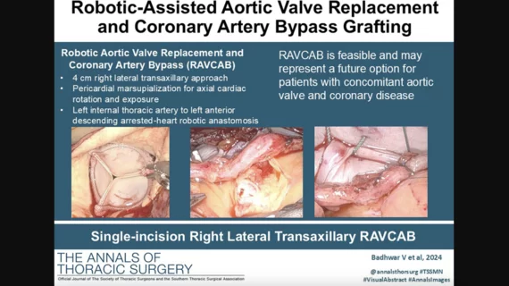 In October 2024, heart surgeons with the WVU Heart and Vascular Institute in Morgantown, West Virginia, performed the world’s first robotic aortic valve replacement and coronary artery bypass (RAVCAB) procedure. Now, the team behind that historic surgery has shared its full story for the first time, publishing an in-depth look at the procedure in The Annals of Thoracic Surgery, an official journal from the Society of Thoracic Surgeons. Graphic and images courtesy of Badhwar et al. and the STS.