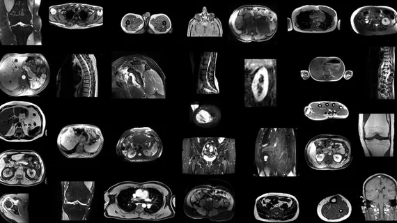 New AI model segments 80 MRI structures