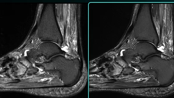 SubtleHD receives FDA clearance for AI-powered MRI solutions