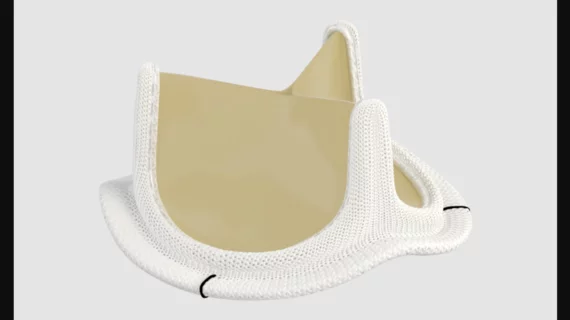 Inspiris Resilia aortic valve from Edwards Lifesciences 