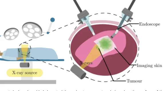 "Imaging skins" could improve surgical removal of cancerous tumors.