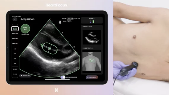HeartFocus DESKi