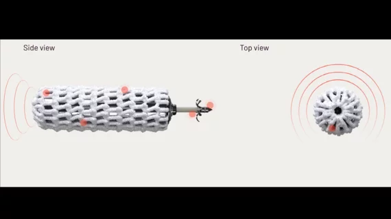 The tiny WiSE CRT system from EBR Systems enables leadless pacing. The WiSE CRT system is approximately the size of a single cooked grain of rice. It works with a patient’s existing implant to provide biventricular pacing. 