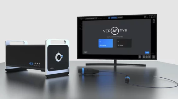 LUMA Vision Verafeye Visualization Platform. The Verafeye Visualization Platform allows operators to deliver 2D and 4D ultrasound images in real time. The catheter was built with maneuverability and increased visibility in mind; it can capture images of up to 120 mm from the tip and provide views of the patient’s anatomy from all angles.