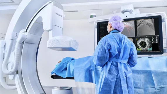 Philips launches clinical trial to study feasibility of ultra-low dose PCI procedures