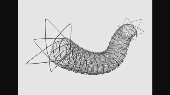 Roadsaver Carotid Stent System