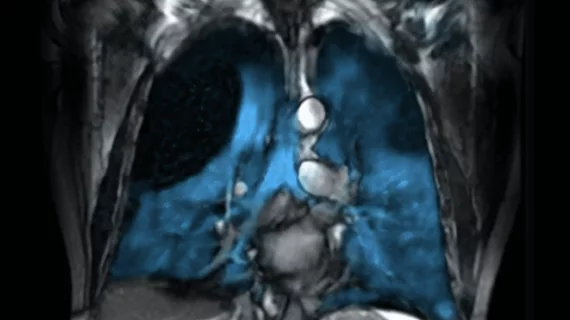 FDA approves expanded use of Xenoview for lung imaging