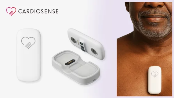 Cardiosense CardioTag