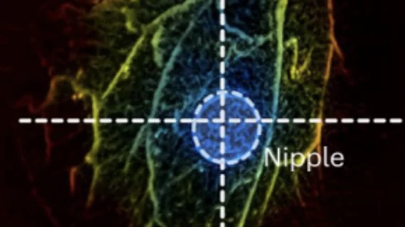 PACT could offer painless alternative to mammograms