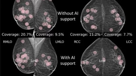 Eye-tracking reveals radiologists' reading habits when under the influence of AI