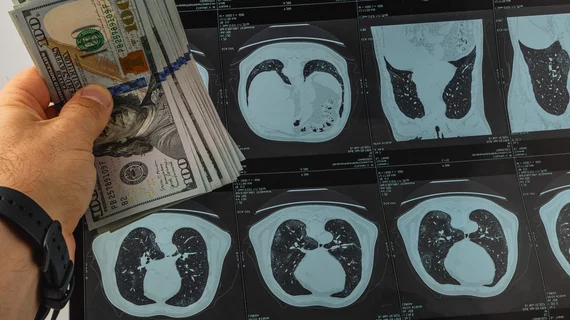 imaging radiology money scans compensation pay dollar
