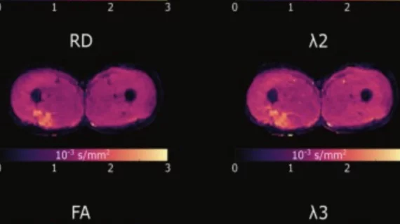DTI improves return to play protocols