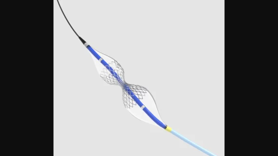 coronary sinus reducer shockwave medical